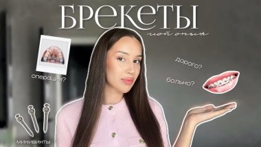 БРЕКЕТЫ: моя история l УДАЛЕНИЕ ЗУБОВ l МИНИВИНТЫ l УСТАНОВКА БРЕКЕТОВ