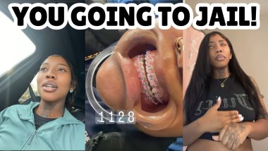 TikTok "Dentist" Is Doing Illegal Braces From Home