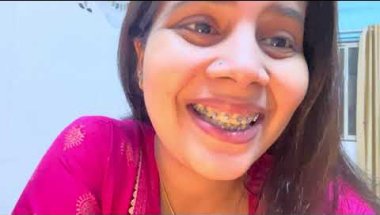 Braces lgane ke baad teeth se blood bhi aate hai 🩸 #viral #trending #youtuber #dentalcare #teeth
