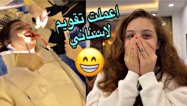 ركبت تقويم اسنان 😁 / شوفو شو لون الي حطيتوا لا يفوتكم ☺️💜
