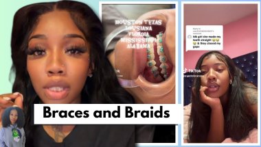 TikToker's Viral Illegal Braces Has Dentists Very Concerned (Part 2)
