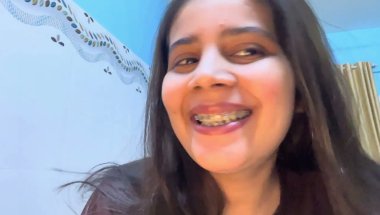 10 Months 8 day braces journey #viral #trending #dentalcare #teeth #youtube #dental #teethwhitening