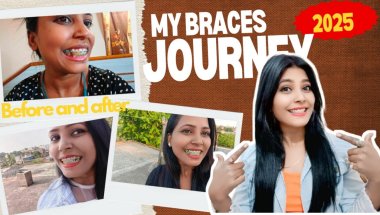 🦷😨BRACES JOURNEY/ TRANSFORMATION 😍/ EXTRACTION/STORY #braces #transformation #journey #motivation