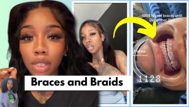 This Illegal Braces Installer Is Mad AT US!