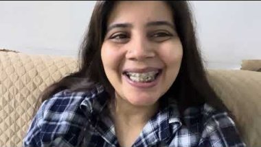 My 10 Months 9 day braces update #viral #dentist #trending #teeth #dentalprosthesis #vlog #youtuber
