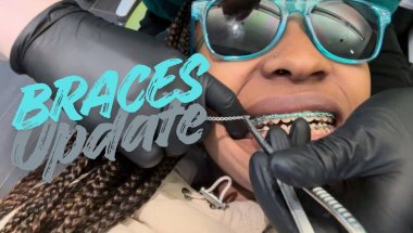Braces Update: ONLY HAVE 2 MORE APPOINTMENTS