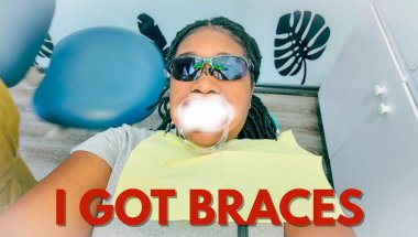 I Got Braces… and It Was WAY Worse Than I Expected 😳
