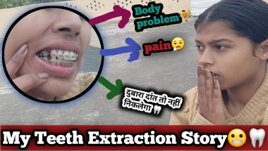 My Teeth Extraction story😬🦷|| Painful ||क्या दांत दोबारा तो नहीं निकलते🦷 😱😱.....