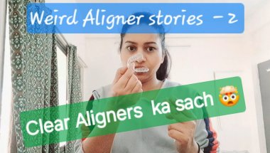My weird Aligner story-2 😕|Aligners के अजीब किस्से🫣 #invisalign #aligners #smile #dentistry #newyear