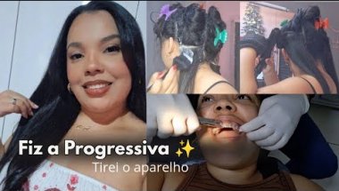 Fiz a Progressiva e Removi o Aparelho Odontológico😱 | Progressiva e Tratamentos