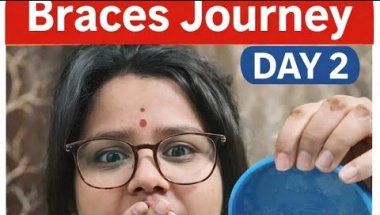 #Type of Braces #Series of Braces Journey Day 2🫢 with twist😯