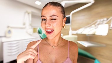 Media 'STAVLJAM FIKSNU PROTEZU' in category 'Fixed Braces: Clear'