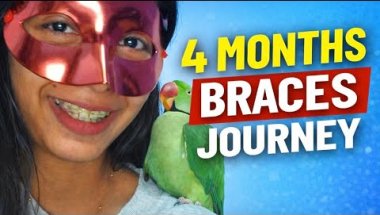 Ceramic Braces 4 Month Update | My Real Experience😁🪥🧿