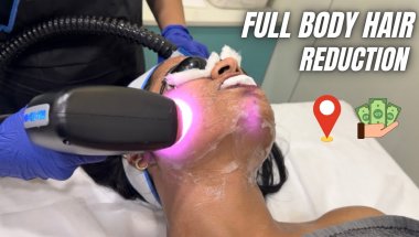 Reality of Hair Laser reduction / Price? / Best place to get/ thing to keep in mind before HLR