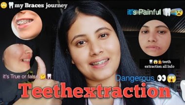 Our Bracesjourney🦷🤔 Teethextraction is Dangerous 😱 it's TrueOr False #braces  #teethextraction