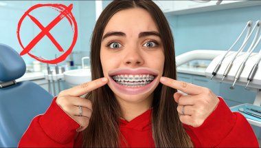 NU-ȚI PUNE APARAT DENTAR  până nu vezi ACEST VIDEO! 😱🦷