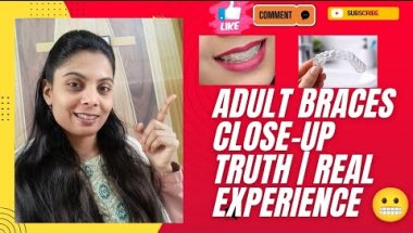 🦷Adult Braces Close-Up Truth Real Experience😱 #adultbracesvlog #bracesjourney #bracescloseup #braces