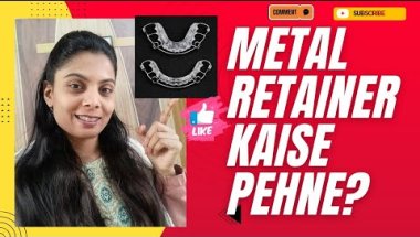 How To Wear Metal Retainers Properly | Metal Retainer After Braces Hindi #braces #adultbraces #teeth