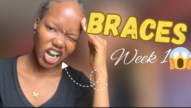My First Week With Braces 😭 | Pain, Eating & What Nobody Told Me