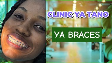 Clinic ya tano ya braces | Mabadiliko makubwa & nini unapaswa kujua.