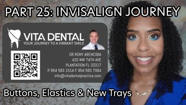 PART 25: INVISALIGN UPDATE OF OFFICE VISIT INSTALLING BUTTONS & ELASTICS!!! #invisalign #rawfootage