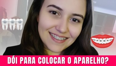 Aparelho ortodôntico: meu relato real nas primeiras horas e dias