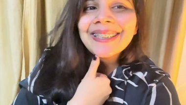 10Months 20 day braces journey #viral #dentist #trending #dentalcare #teeth #braces #youtube #dental