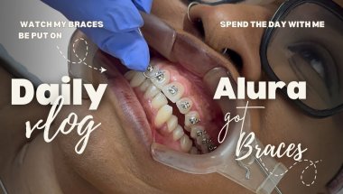 "🔥 BRACES DAY! 🚀 Join me, Alura, as I get my teeth straightened 😁💖"#braces #bracescolors  #fypシ