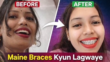 Braces kyun lagwaye? #braces #vlog #tranding #dentalcare