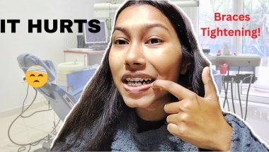 Is Braces Tightening Painful? 😵‍💫 What No One Tells You