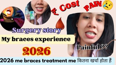 Braces treatment क्यों जरूरी हैं??? 2026 braces reality 😳 😱!!Real Braces Experience