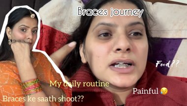 Braces Journey Begins | Honest First Day Vlog