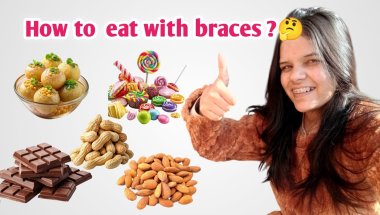 How to  eat with braces ?🤔#youtube #bracesjourney