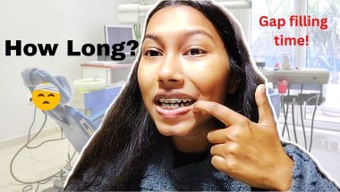 Tooth Extraction with Braces: Will the Gap Ever Close?