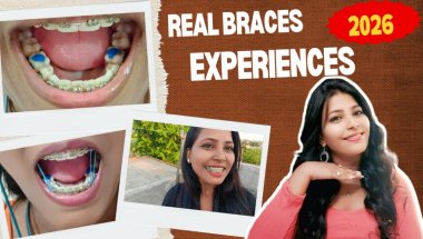 My Braces: A "Full Mouth Tour" - Cavities, Fillings, & Pain Explained!