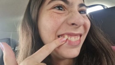 Media 'COLOQUEI APARELHO! VLOG INDO AO DENTISTA' in category 'Expander (RPE)'