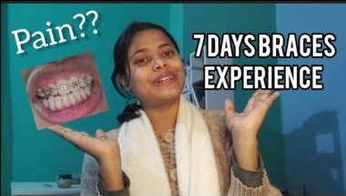 Braces ke 7 Din Baad Ka Experience 😬 | Pain, Eating, Care & Reality | Hindi #braces #bracespain #yt