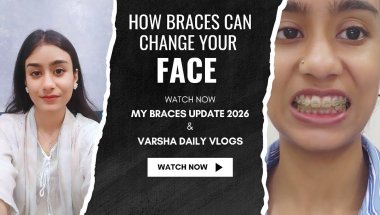 My Braces Treatment Update On 2026 | Varsha Daily Vlogs | #trending