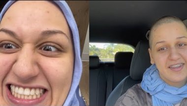 BALD GIRL GETS BRACES OFF…