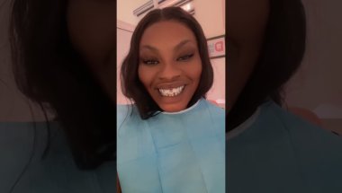 Braces journey 😬
