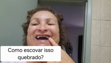 ROTINA DE QUANDO ACORDO/COMO FAÇO PRA ESCOVAR OS DENTES DA PRÓTESE PROTOCOLO QUEBRADA