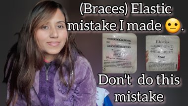 Elastic mistake I made with braces. Don't repeat this mistake.