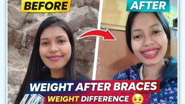 Braces ke baad mera weight kyun kam ho rha h?😖😫 Honest experience #braces #vlog #tranding