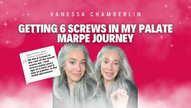 Getting 6 screws in my palate & My MARPE journey