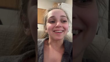Shauna Rae: Invisalign Day 141