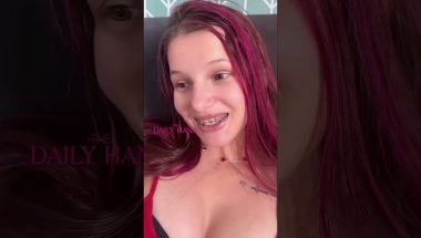 I’m wearing new braces