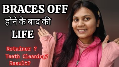 Life after braces🦷🧐How to maintain teeth after braces❓