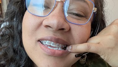 Braces at 31?!