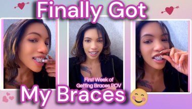 Getting Braces as an Adult | Day 1-7 With Braces 💕