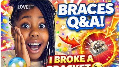 My BRACES Journey: Answering ALL Your "Is It Worth It?" Questions!